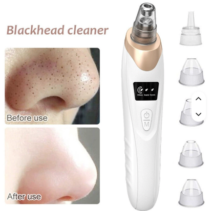✨ LIMPIADOR FACIAL DE POROS ELÉCTRICO